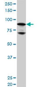 NR3C1 Antibody in Western Blot (WB)