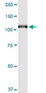 GRM6 Antibody in Western Blot (WB)