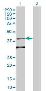 GSK3B Antibody in Western Blot (WB)