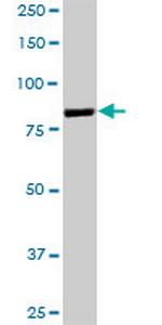 GSN Antibody in Western Blot (WB)