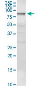 GSN Antibody in Western Blot (WB)