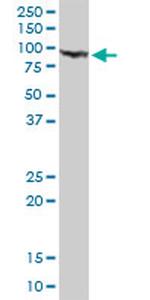 GSN Antibody in Western Blot (WB)