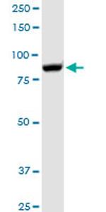 GSN Antibody in Western Blot (WB)