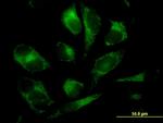 GSTM2 Antibody in Immunocytochemistry (ICC/IF)