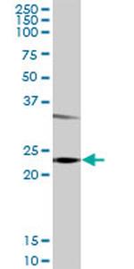 GSTP1 Antibody in Western Blot (WB)