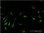 GSTP1 Antibody in Immunocytochemistry (ICC/IF)