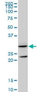 GSTZ1 Antibody in Western Blot (WB)