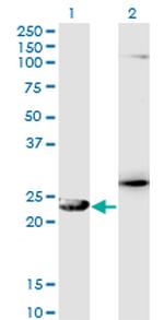 GSTZ1 Antibody in Western Blot (WB)