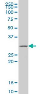 GSTZ1 Antibody in Western Blot (WB)