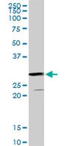 GSTZ1 Antibody in Western Blot (WB)