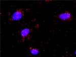 MSH6 Antibody in Proximity Ligation Assay (PLA) (PLA)