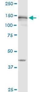 MSH6 Antibody in Western Blot (WB)