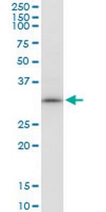 GTF2B Antibody in Western Blot (WB)