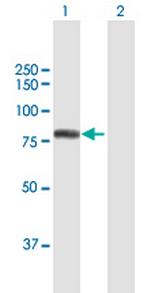 GTF2F1 Antibody in Western Blot (WB)