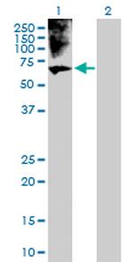 BRF1 Antibody in Western Blot (WB)