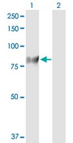 GUCY1A3 Antibody in Western Blot (WB)