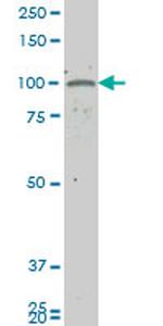 GUCY2C Antibody in Western Blot (WB)