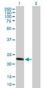 GUK1 Antibody in Western Blot (WB)