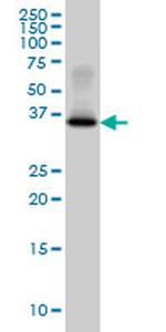 GYG1 Antibody in Western Blot (WB)