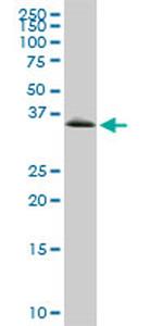 GYG1 Antibody in Western Blot (WB)