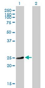 HSD17B10 Antibody in Western Blot (WB)