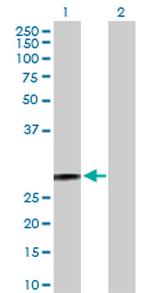 HSD17B10 Antibody in Western Blot (WB)