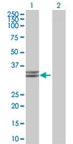 HADHSC Antibody in Western Blot (WB)