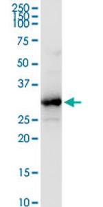 HADH Antibody in Western Blot (WB)