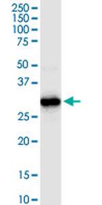 HADH Antibody in Western Blot (WB)