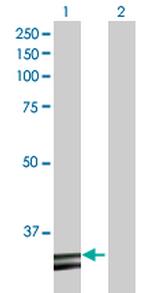 HADH Antibody in Western Blot (WB)