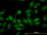 HADHSC Antibody in Immunocytochemistry (ICC/IF)