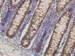 HADHSC Antibody in Immunohistochemistry (Paraffin) (IHC (P))