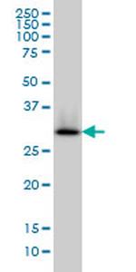 HADHSC Antibody in Western Blot (WB)