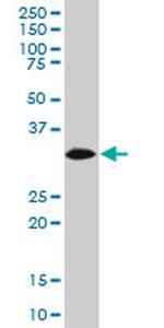 HADHSC Antibody in Western Blot (WB)