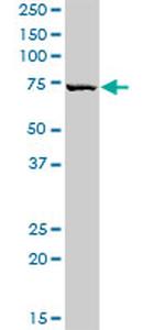 HAL Antibody in Western Blot (WB)