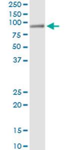 HAL Antibody in Immunoprecipitation (IP)