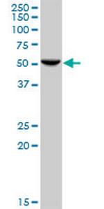 HARS Antibody in Western Blot (WB)