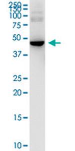 HARS Antibody in Western Blot (WB)