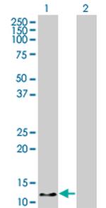 HBZ Antibody in Western Blot (WB)