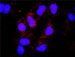 HCK Antibody in Proximity Ligation Assay (PLA) (PLA)