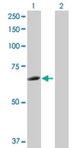 HCK Antibody in Western Blot (WB)