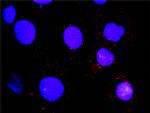 HCK Antibody in Proximity Ligation Assay (PLA) (PLA)