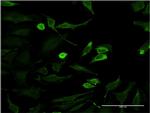 HD Antibody in Immunocytochemistry (ICC/IF)