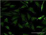 HD Antibody in Immunocytochemistry (ICC/IF)