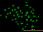 HDAC1 Antibody in Immunocytochemistry (ICC/IF)