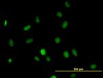 HDAC1 Antibody in Immunocytochemistry (ICC/IF)