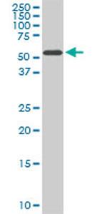 HDAC1 Antibody in Western Blot (WB)