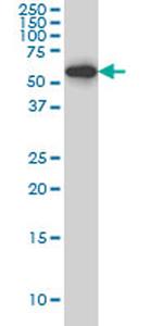 HDAC1 Antibody in Western Blot (WB)