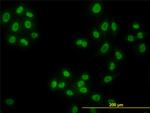 HDAC1 Antibody in Immunocytochemistry (ICC/IF)