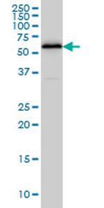 HDAC1 Antibody in Western Blot (WB)